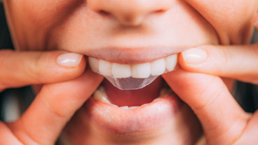 Whitening Strips: DIY & Dentist Teeth Cleaning Solutions